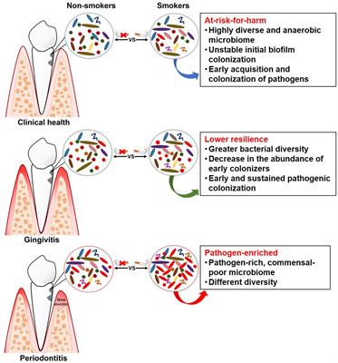The Impact of Smoking on Subgingival Microflora: From <mark class="highlighted">Periodontal Health</mark> to Disease